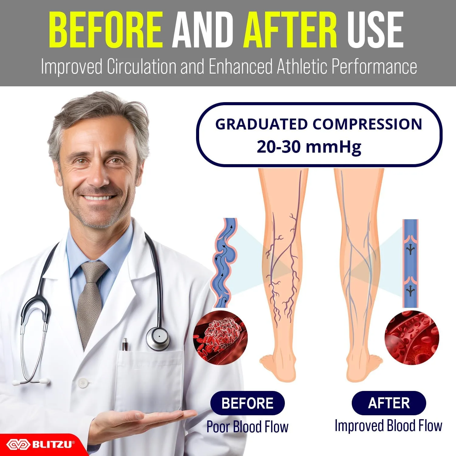 BLITZU Compression Socks For Women & Men Support Socks For Circulation, Compression Stockings For Women.